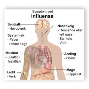 Symptom ved influensa